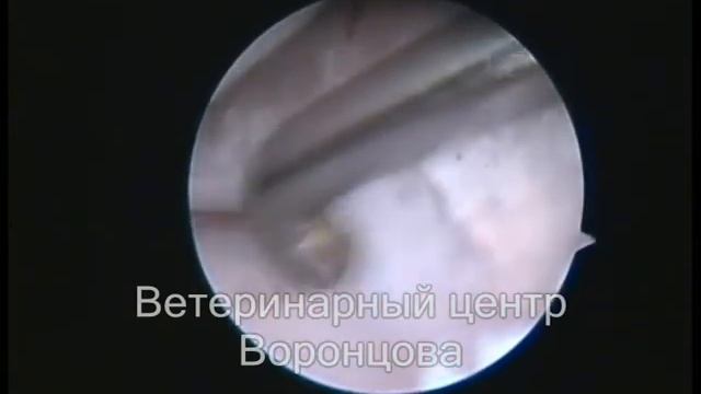 Релиз медиального мениска смотреть онлайн