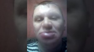 Губы опухла