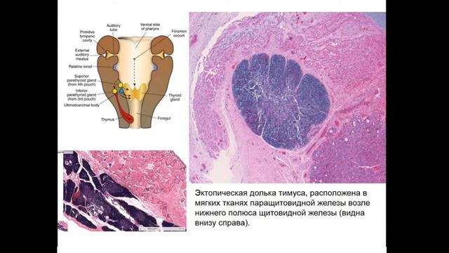 Органы кроветворения и иммунной защиты смотреть онлайн