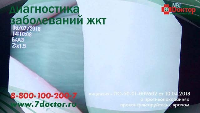 Комплексная диагностика желудочно-кишечного тракта (ЖКТ) смотреть онлайн