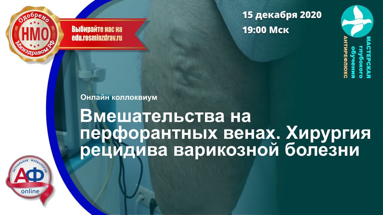 Вмешательства на перфорантных венах. Хирургия рецидива варикозной болезни смотреть онлайн