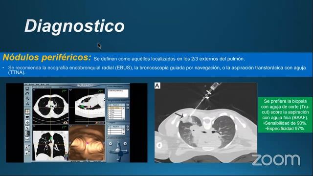 Non-Small Cell Lung Cancer. An Introduction Josué Avelar, M.D. смотреть онлайн
