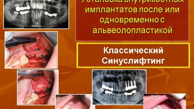 Презентация стоматологического факультета ТГМА смотреть онлайн