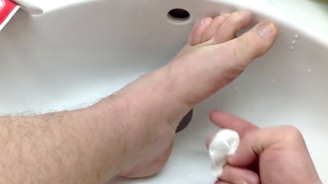 Если воняют ноги смотреть онлайн