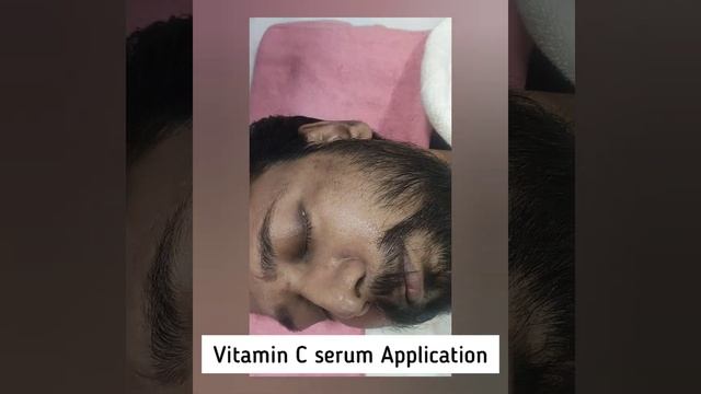 Subcision with PRP/ PRP injections/Micro-needling/Mesotherapy/Prp/Acne Scars/Open pores/Medic/lpu смотреть онлайн