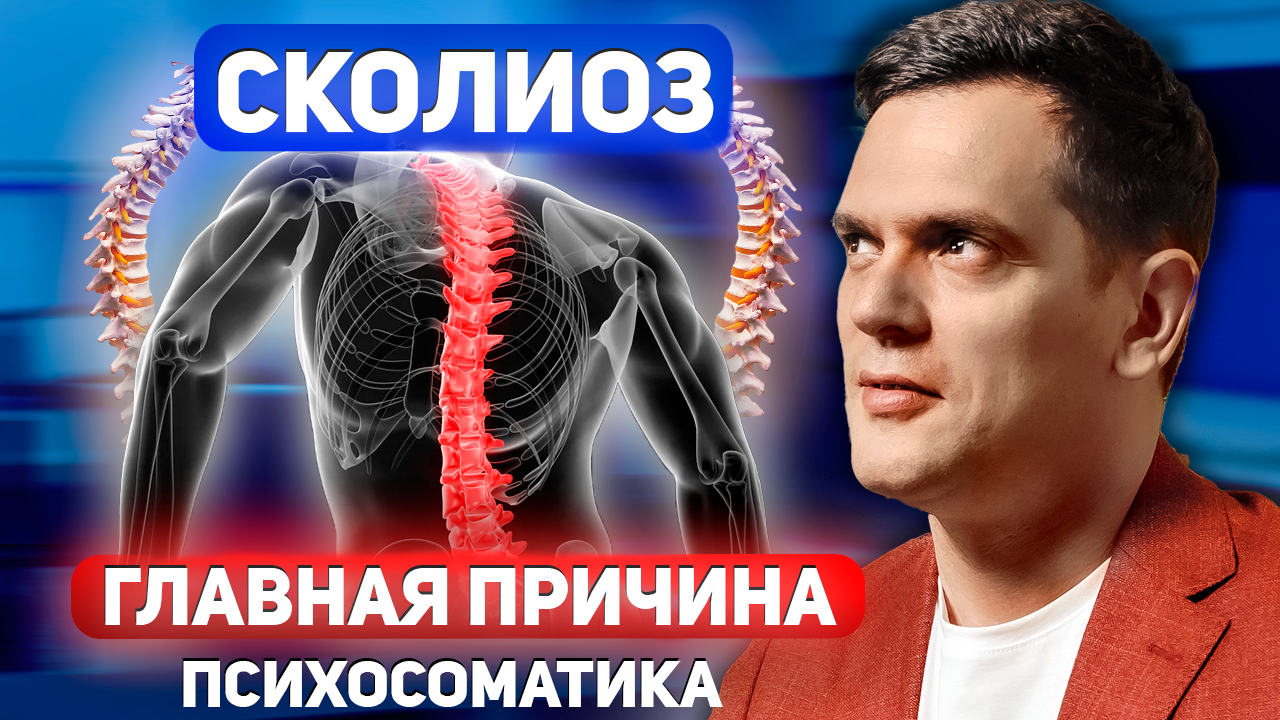 СКОЛИОЗ. Как бороться со сколиозом у детей и взрослых в домашних условиях ? смотреть онлайн