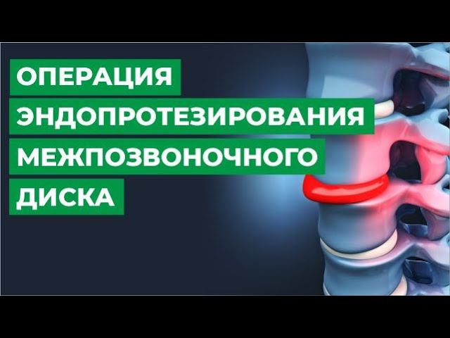 Операция по эндопротезированию межпозвонкового диска