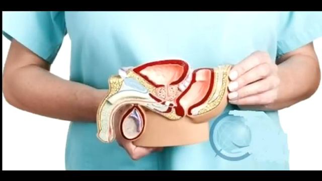 Эректильная дисфункция. Тест самурая смотреть онлайн