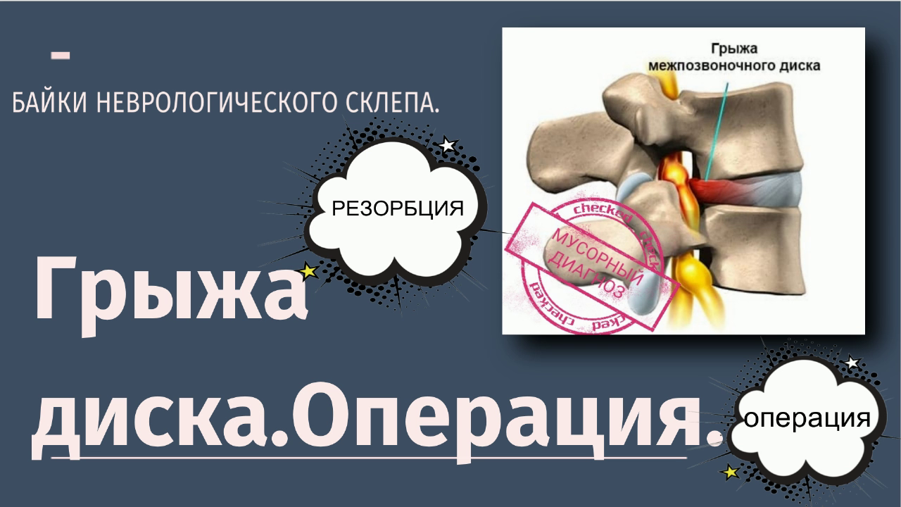 Грыжа диска.Операция.