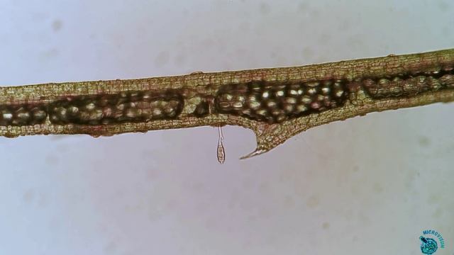 Кругоресничные инфузории (Peritricha) смотреть онлайн