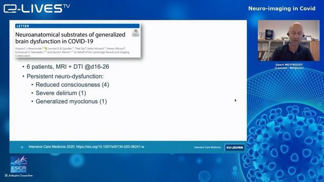 Neurological complications of Covid patients смотреть онлайн