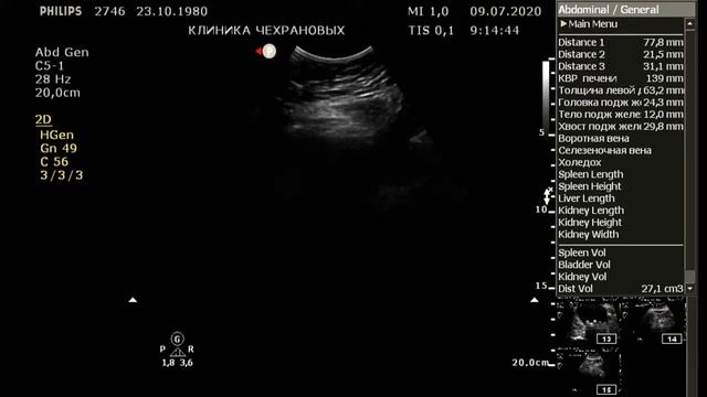 УЗИ органов брюшной полости и почек, терапевт Докучаева , клиника Чехрановых, 2020 07 09 09 05 1 смотреть онлайн