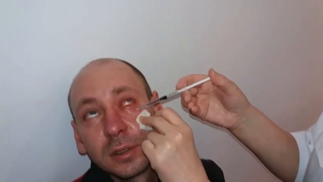 Укол в глаз! Больно или нет? смотреть онлайн