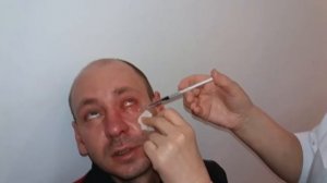Укол в глаз! Больно или нет?