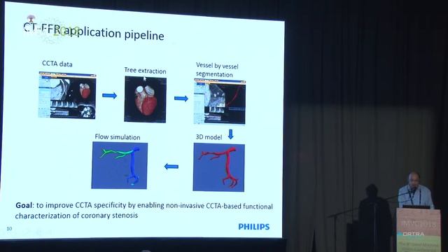 Moti Freiman - The Invisible Becomes Quantifiable in Coronary Computed Tomography Angiography Exams смотреть онлайн