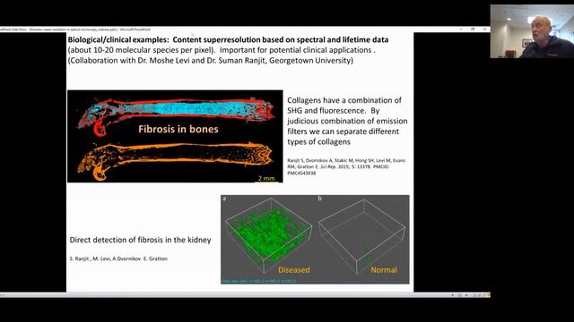 Dynamic Super-Resolution in Optical Microscopy, Dr. Enrico Gratton смотреть онлайн