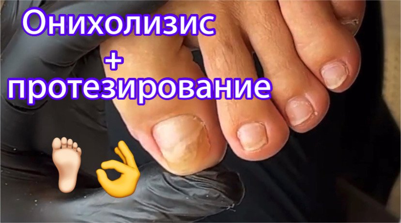 IMG_1944.MOV смотреть онлайн