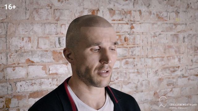 RU. Отзыв Роберта. Трихопигментация лучше чем пересадка волос. Scalp Micropigmentation. смотреть онлайн