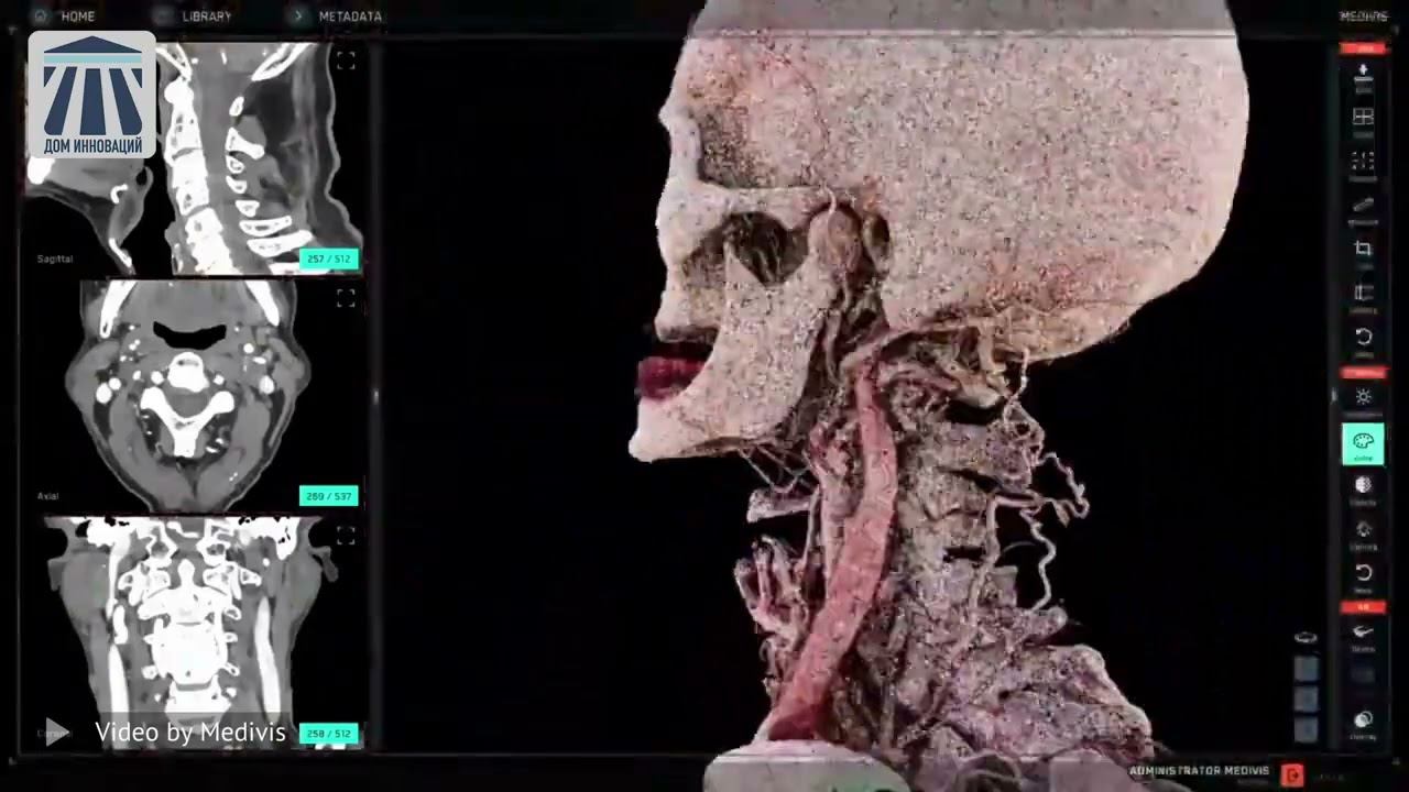 149 Innovation From Medivis (House Of Innovation)