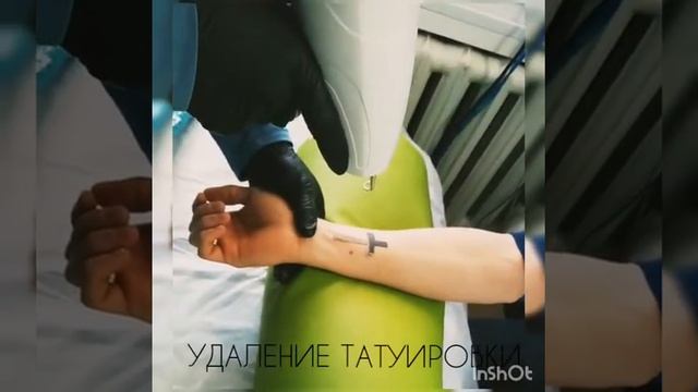 Удаление татуировки! Процедура №1 смотреть онлайн