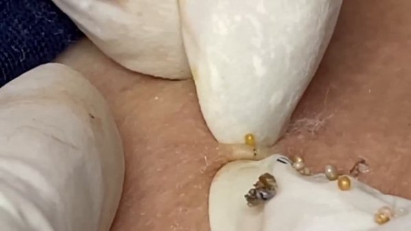 ???? ? ????? ???? #991