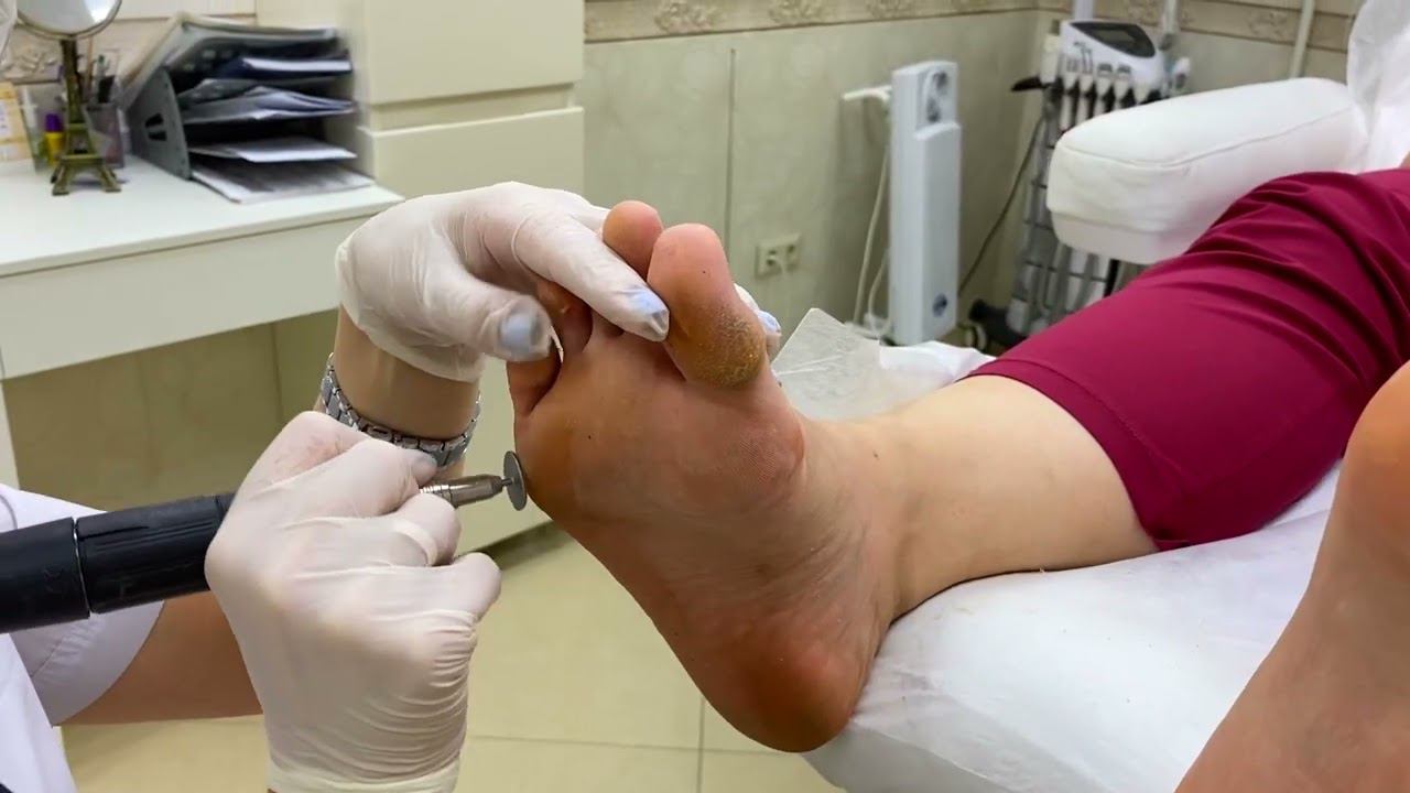 SMART-педикюр смотреть онлайн