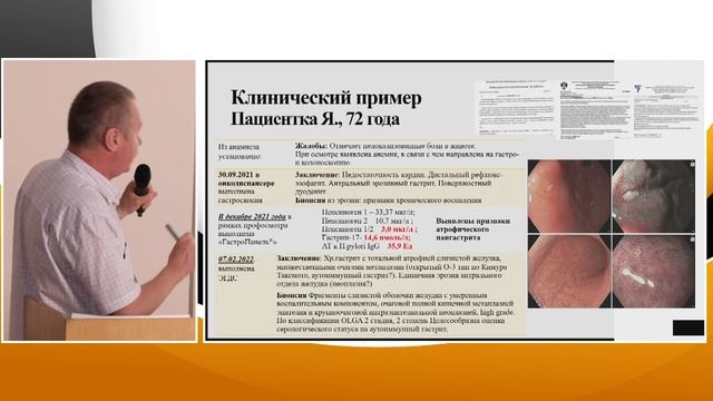 3. Назаров В.Е. Скрининг рака желудка смотреть онлайн