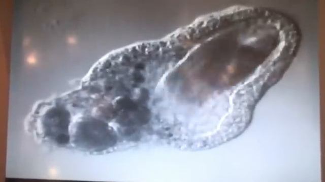 Amoeba Eats Two Paramecia (Amoeba's Lunch)