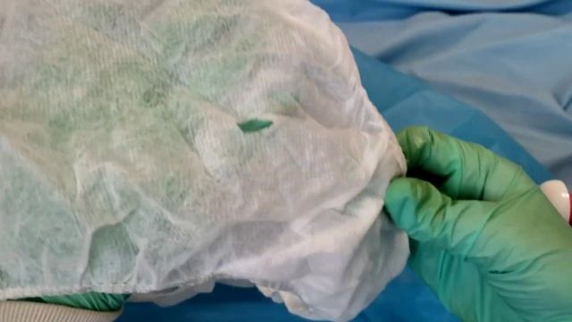 Неуловимый пациент.Никак не хочет делать процедуру. смотреть онлайн