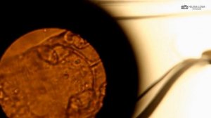 КАК СДАТЬ АНАЛИЗ? Подкожный клещ ДЕМОДЕКС под МИКРОСКОПОМ. СИМПТОМЫ.  Как определить ДЕМОДЕКОЗ?