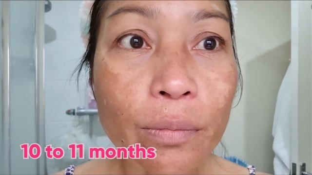 Talking my Skincare for Melasma and Darkspot with Eucerin and how long do I use смотреть онлайн