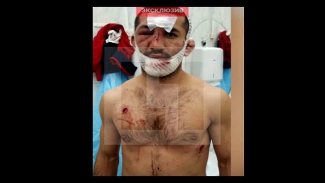 Расул Мирзаев опознал нападавшего. Им оказался друг спортсмена из UFC. смотреть онлайн