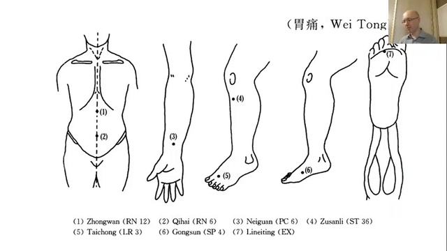 Гоголь И.А. Клиническая акупунктура. Лечение заболеваний внутренних органов. смотреть онлайн