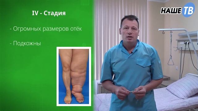 Азбука здоровья "Лимфедема" смотреть онлайн