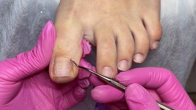УЖАС ЧТО С НОГАМИ ПОСЛЕ НОСОЧКОВ ? ОГРОМНЫЕ НАТОПТЫШИ ? Педикюр ? Френч на ногах смотреть онлайн