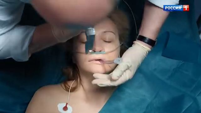 Интубация трахеи