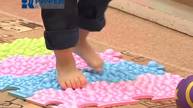 Плоскостопие