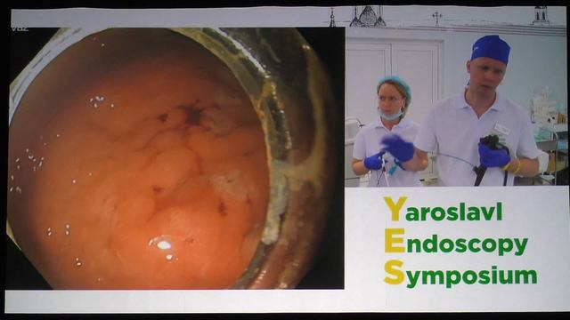 10Live Ткаченко ОБ EFTR GIST желудка полностенная эндоскопическая резекция ГИСО