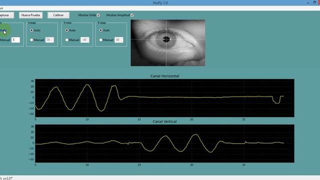 Pupil detection - Python and OpenCV - Videonistagmography System смотреть онлайн
