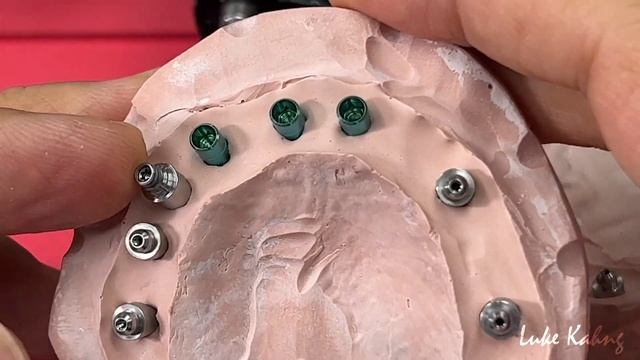 Eccentric Implant Prosthetic Options смотреть онлайн