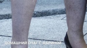 ГОРЯТ НОГИ ,  СТУПНИ ? ЭТО УЖЕ ...