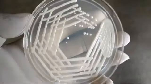 Candida in KOH mount, growth on SDA, Germ tube test and AFST смотреть онлайн