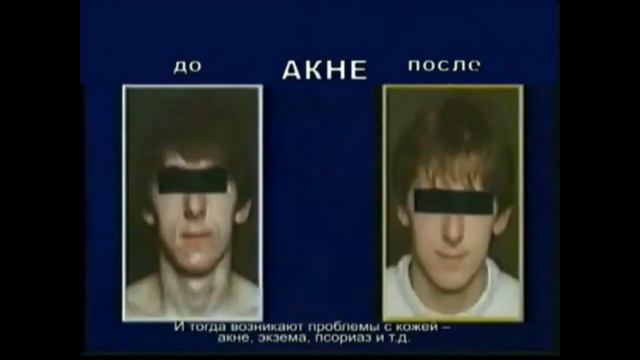 Как работает набор АНТИ ЭЙДЖ от LR смотреть онлайн