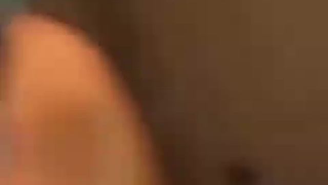 Ангина, выдавливание гноя. Tonsil stones смотреть онлайн