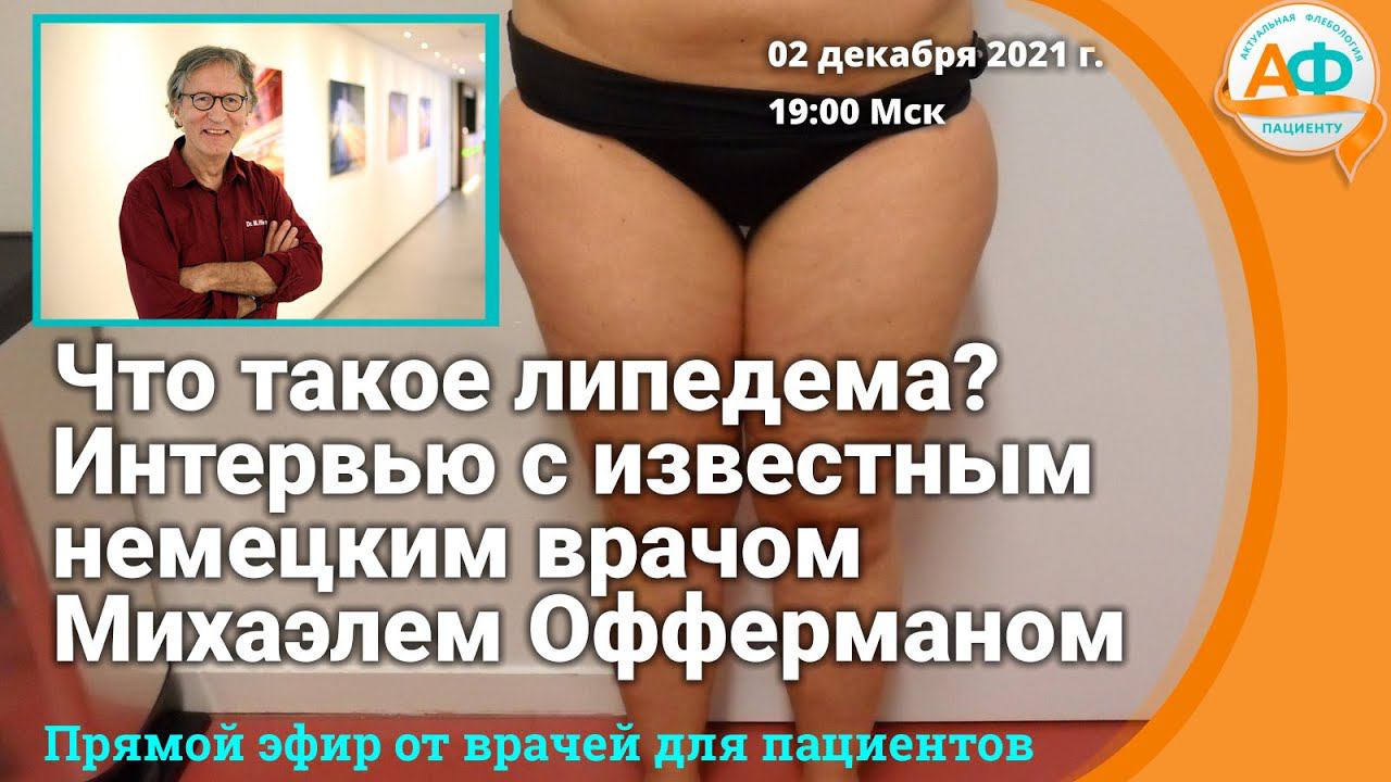 Что такое липедема? Интервью с известным немецким врачом Михаэлем Офферманом смотреть онлайн