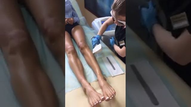 Лазерная эпиляция || Milner Medical смотреть онлайн
