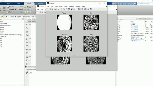Retina Image Segmentation With Wavelet Transform From Scratch: Matlab Code смотреть онлайн
