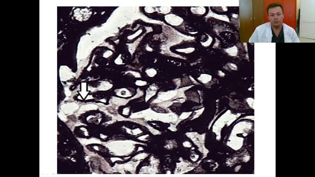 Патологическая анатомия как наука смотреть онлайн