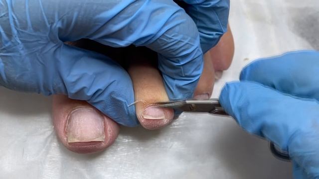 Педикюр после дачи ? Ногти коршуны / Обработка стоп дисками смотреть онлайн