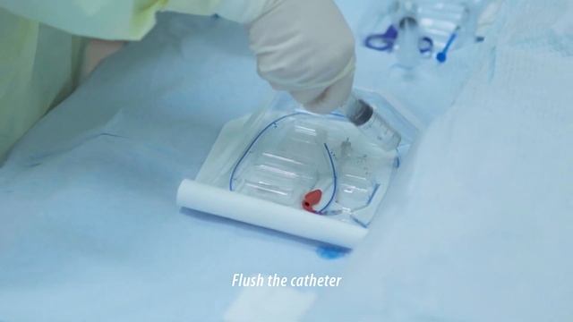 U8 Catheter-positioning Guiding System - Product Introduction and Operation смотреть онлайн